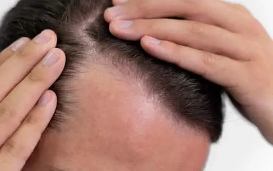 Adult male looking at his hair